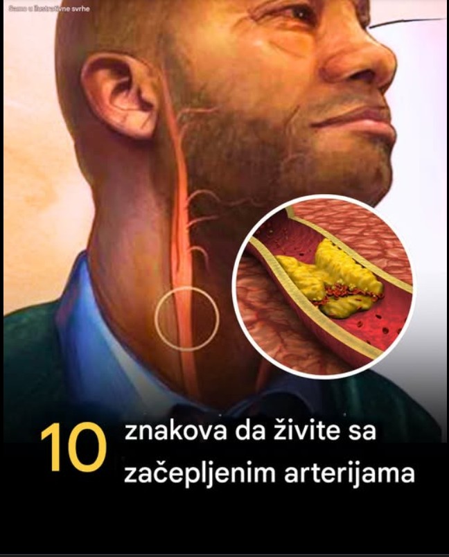 10 mogućih znakova zapušenih arterija koje ne bi trebalo ignorisati