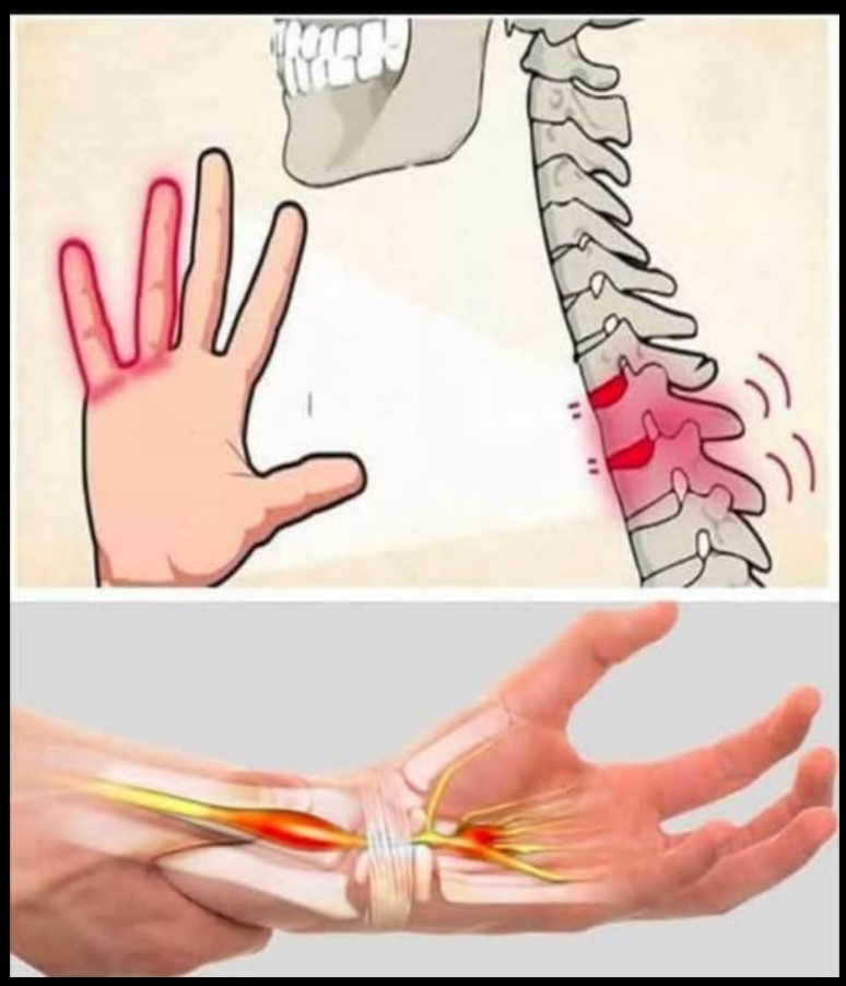 Zašto ruke i stopala ponekad utrnu i kako ublažiti taj osjećaj