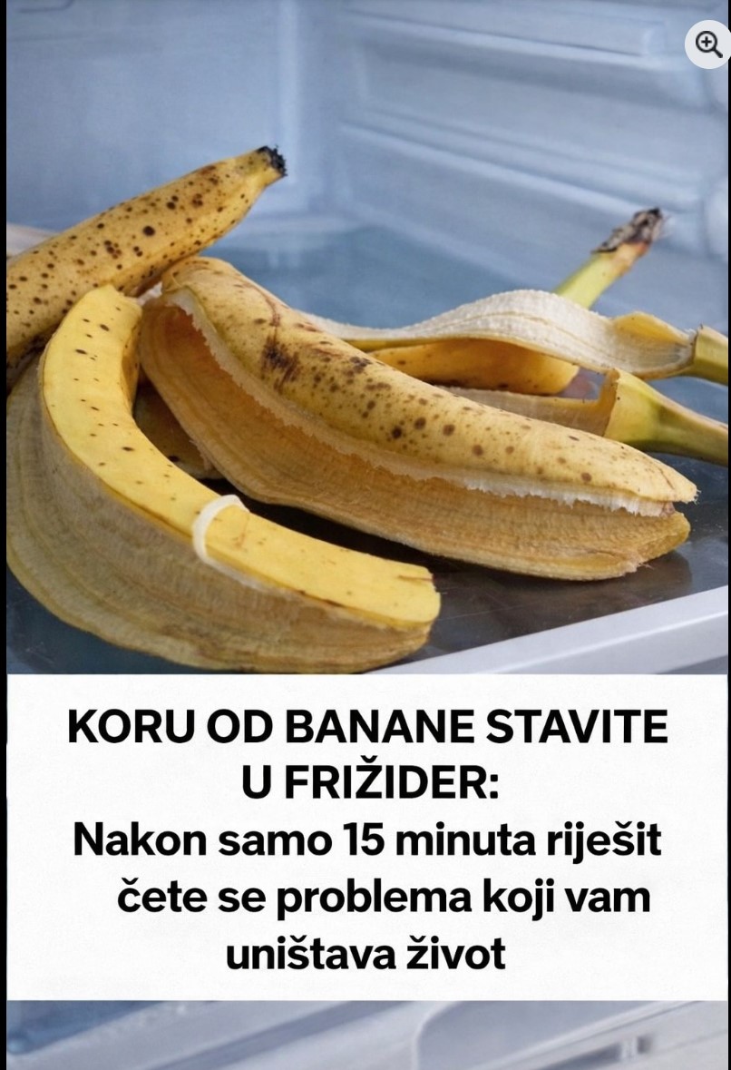 Prirodni trik za glavobolju: kako banana i njena kora mogu učiniti olakšanje