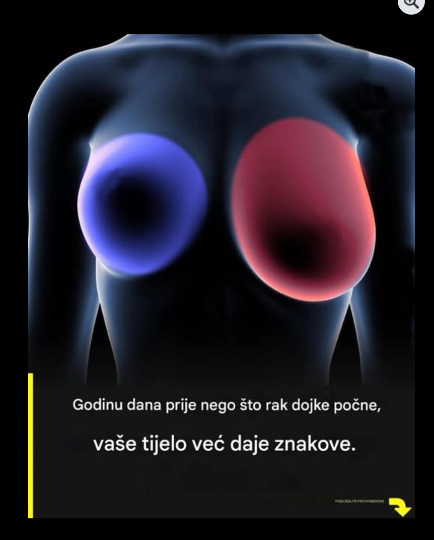 Rani znaci na dojkama koje bi svaka žena starija od 60 godina trebala poznavati