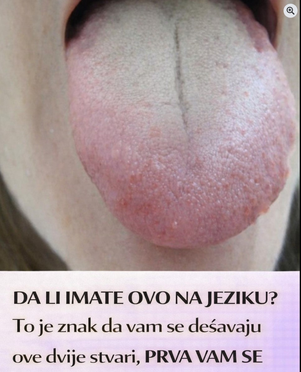 Šta znači brazde na jeziku i kada treba obratiti pažnju