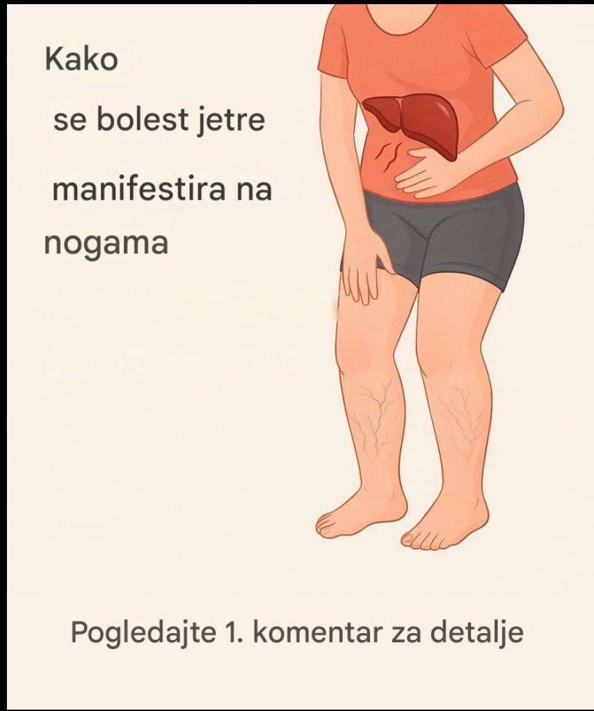 Znakovi koje ne treba ignorisati: kako promene na nogama mogu ukazivati na probleme sa jetrom