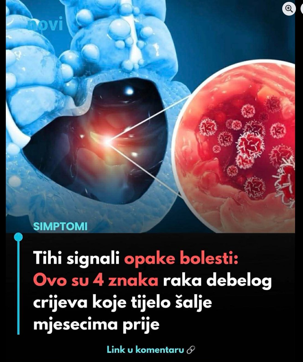 Rani simptomi raka debelog crijeva: Četiri znaka koje tijelo može slati mjesecima prije dijagnoze