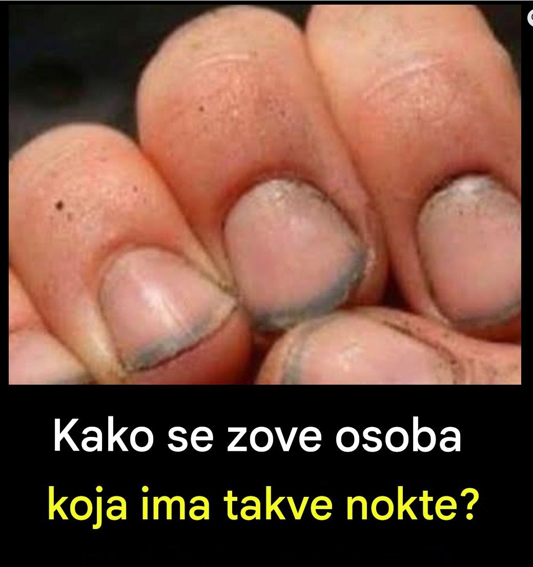 Prsti sa prljavim noktima: znak zapuštenosti ili dokaz napornog rada?