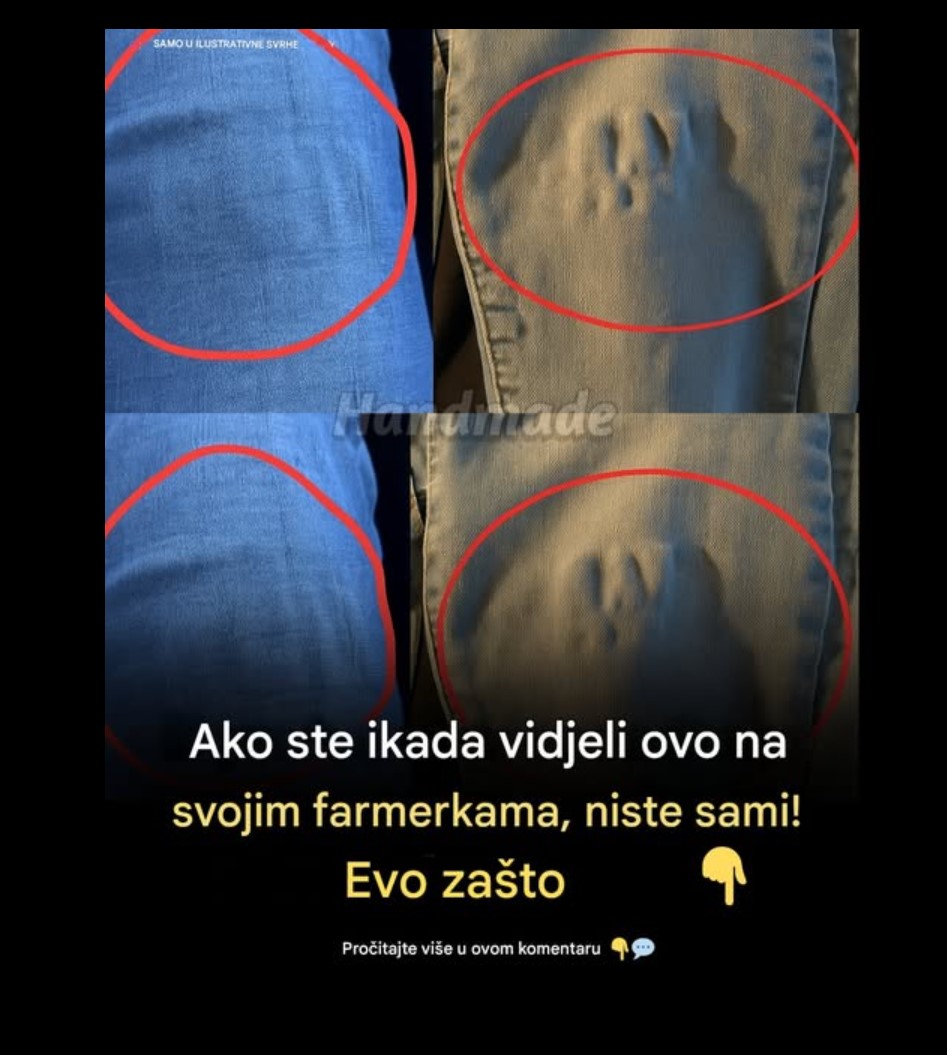 Talasi na farmerkama: zašto se javljaju i kako ih popraviti