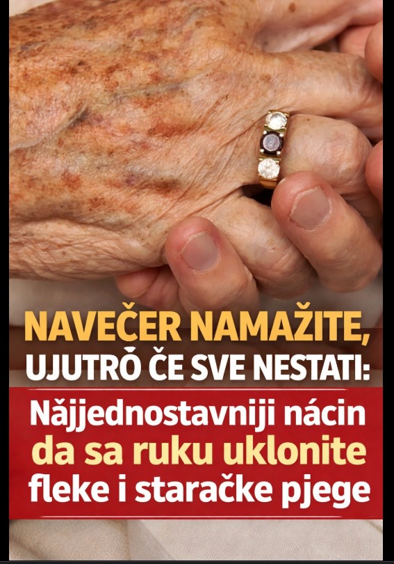 Prirodna njega ruku: Jednostavan način za ublažavanje fleka i znakova starenja