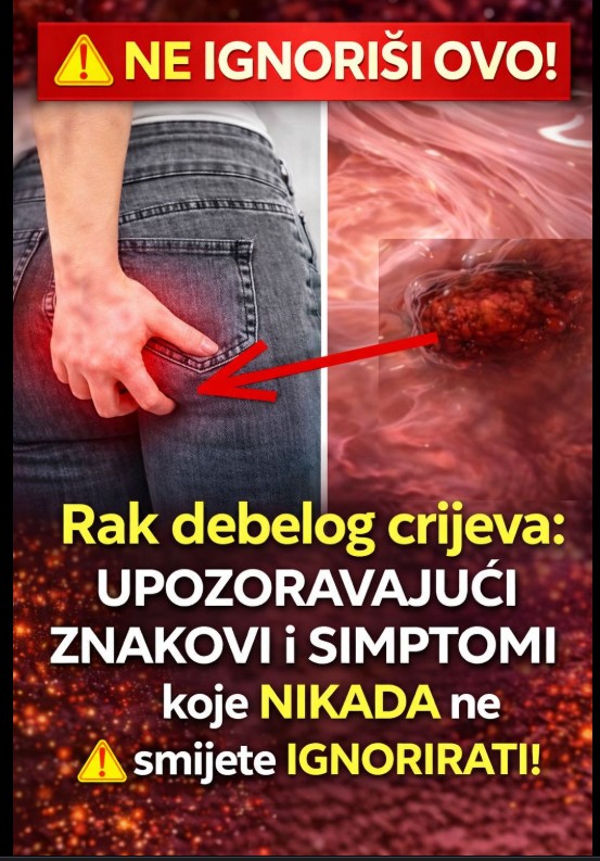 Rak debelog crijeva: Upozoravajući znakovi i simptomi koje ne smijete ignorirati