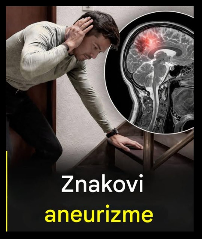 Aneurizma: rani simptomi koje muškarci ne smeju ignorisati