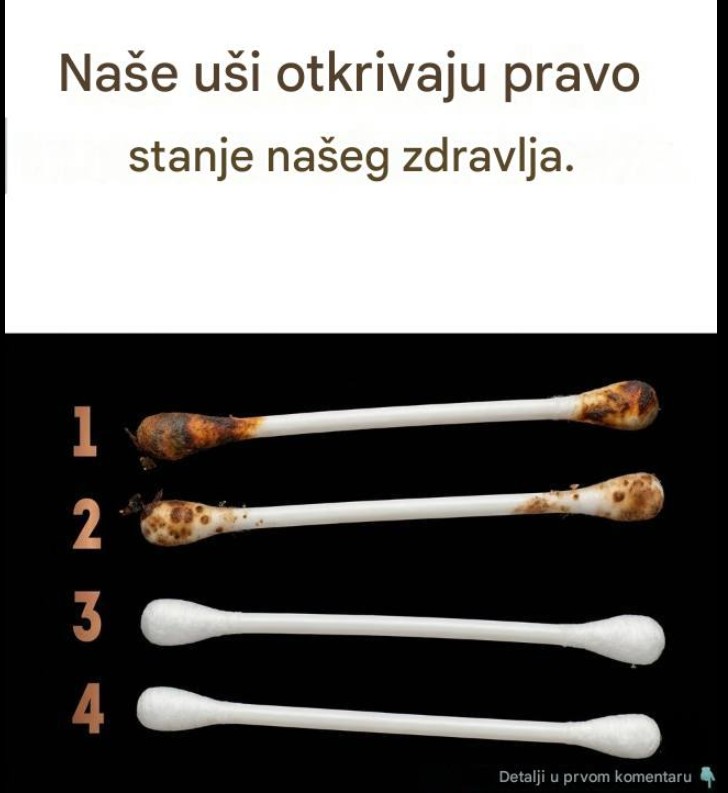 Mali signali koje nam uši šalju: Šta izgled i tekstura ušne masti mogu otkriti o vašem zdravlju?