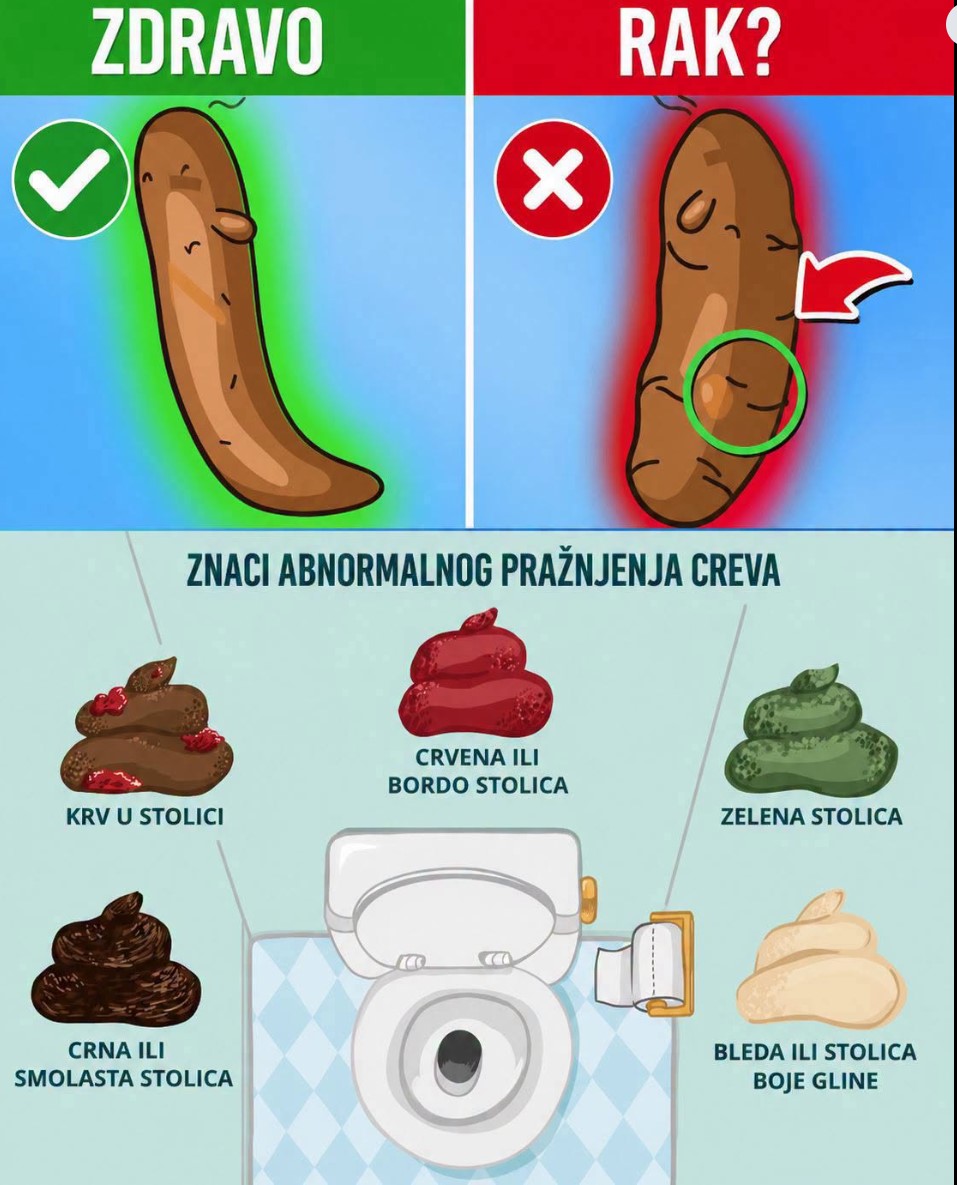 Boja stolice može otkriti mnogo o zdravlju: Evo kada promjena nije bezazlena