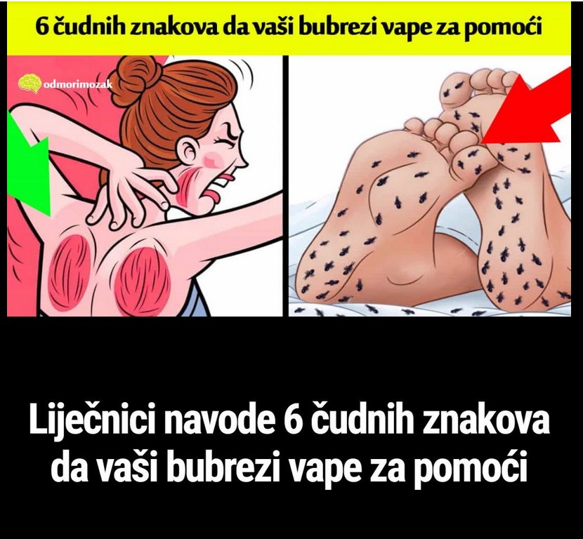 Liječnici navode 6 čudnih znakova da vaši bubrezi vape za pomoći