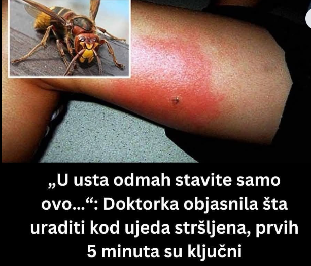 „U usta odmah stavite samo ovo…“: Doktorka objasnila šta uraditi kod ujeda stršljena, prvih 5 minuta su ključni