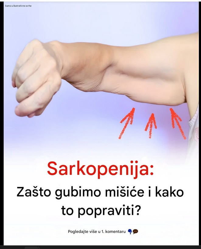 Posle pedesete sve teže nosite kese i penjete se uz stepenice: Mišići vam možda šalju važno upozorenje