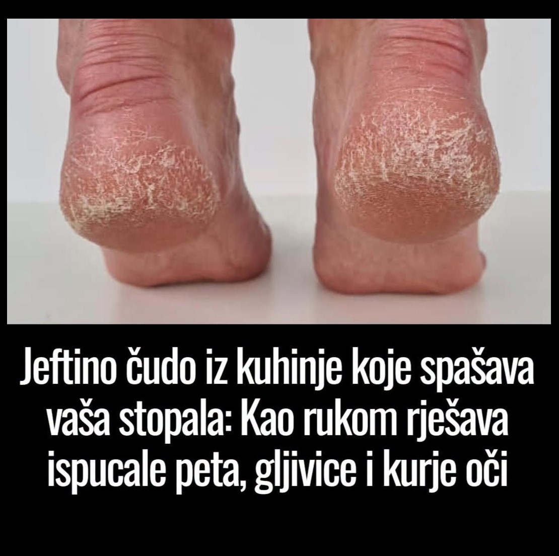 Jeftino čudo iz kuhinje koje spašava vaša stopala: Kao rukom rješava ispucale pete, gljivice i kurje oči