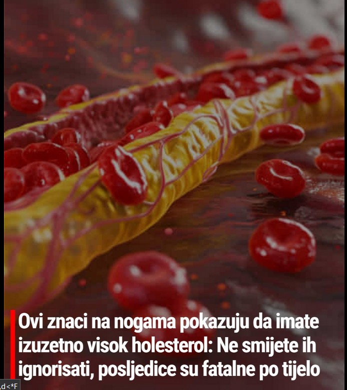 Ovi znaci na nogama pokazuju da imate izuzetno visok holesterol: Ne smete ih ignorisati, posledice su fatalne po telo
