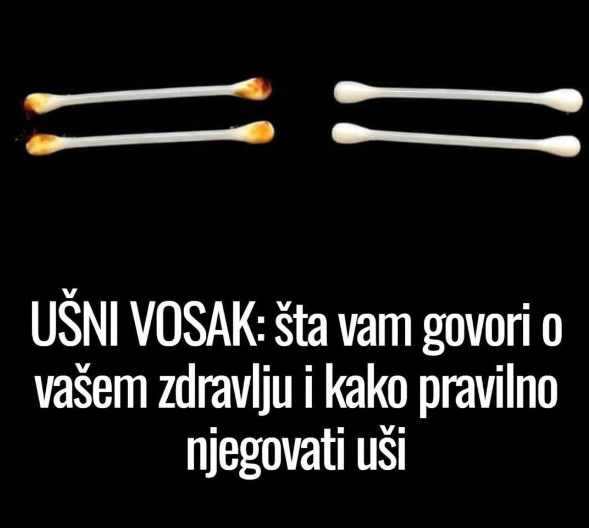 UŠNI VOSAK: Šta vam govori o vašem zdravlju i kako pravilno negovati uši