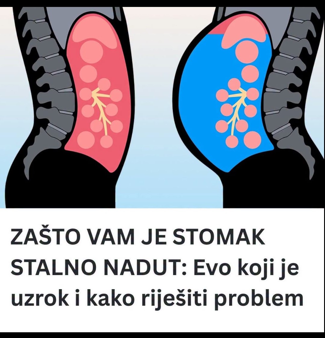 Zašto vam je stomak stalno nadut? Najčešći uzroci i korisni savjeti za ublažavanje tegoba