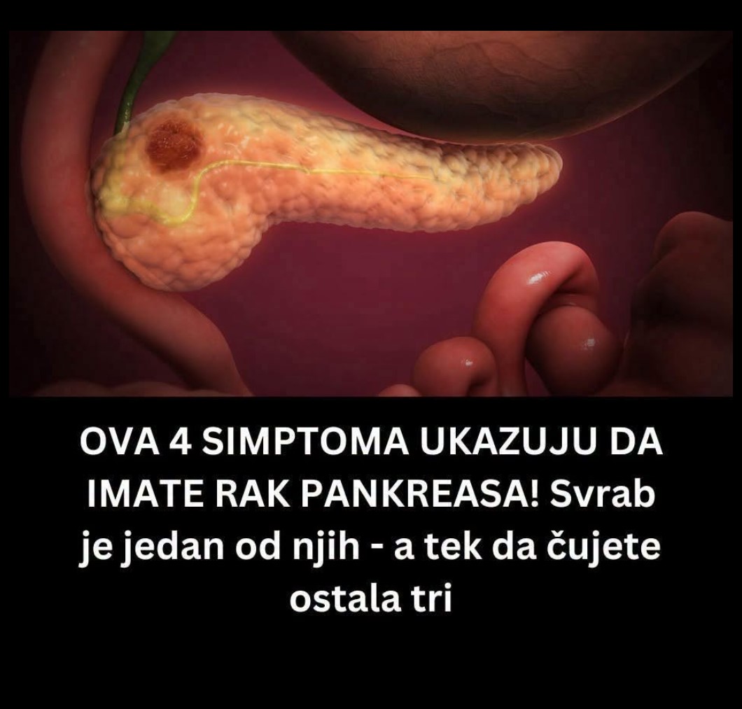 SIMPTOMI KOJE NE SMETE IGNORISATI: Kako na vreme prepoznati znake koji mogu ukazivati na rak pankreasa