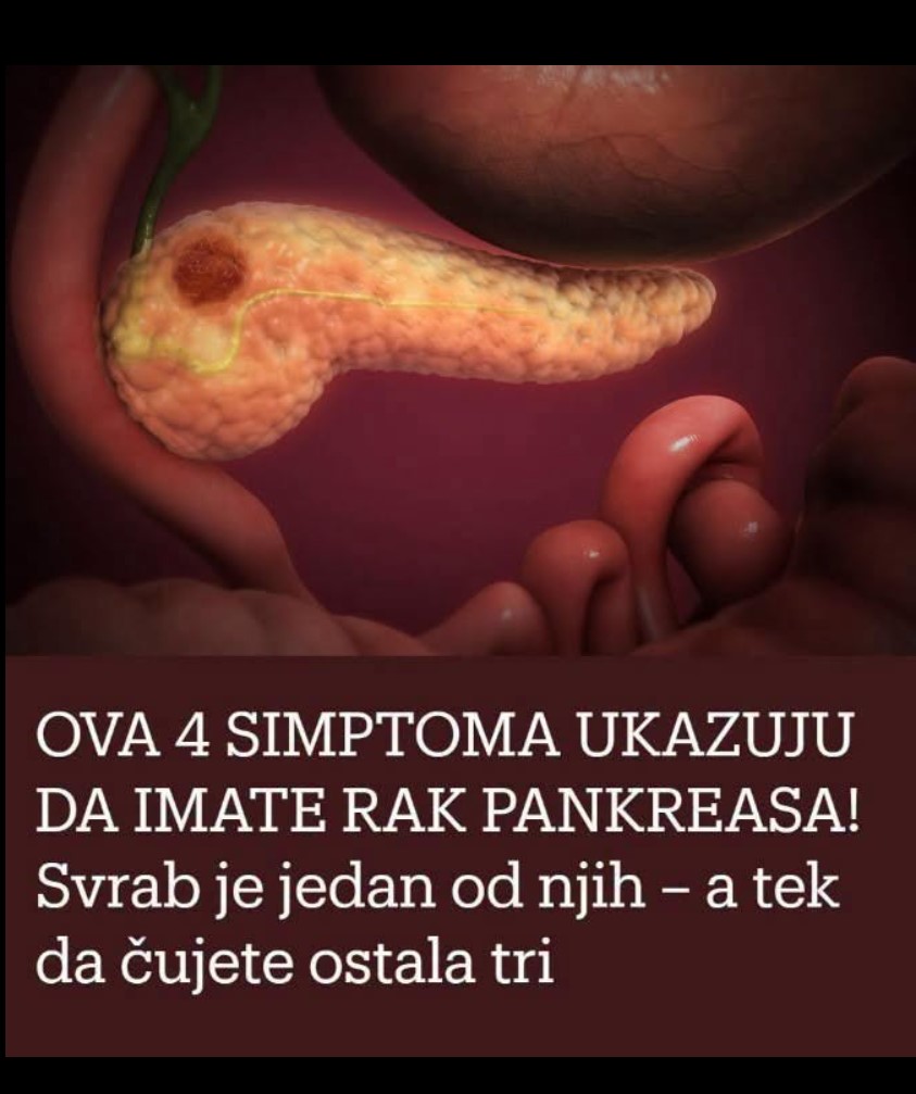 Simptomi raka pankreasa koje ne treba zanemariti: Promjene koje mogu biti važan znak upozorenja