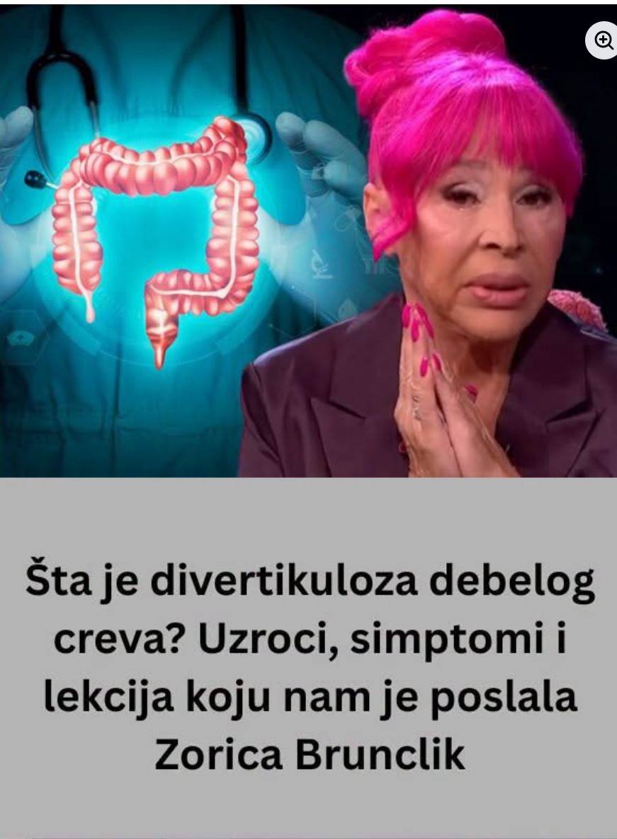 Šta je divertikuloza debelog creva? Uzroci, simptomi i zašto je važno reagovati na vreme