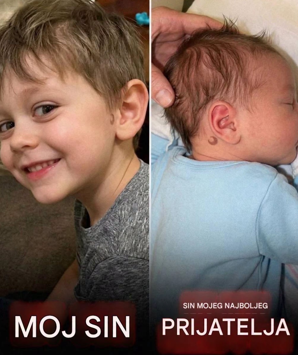 Mislila Sam Da Me Muž Vara Sa Najboljom Prijateljicom Zbog Istog Retkog Belega Na Bebama: Istina Iz Klinike Za Plodnost Bila Je Mnogo Gora