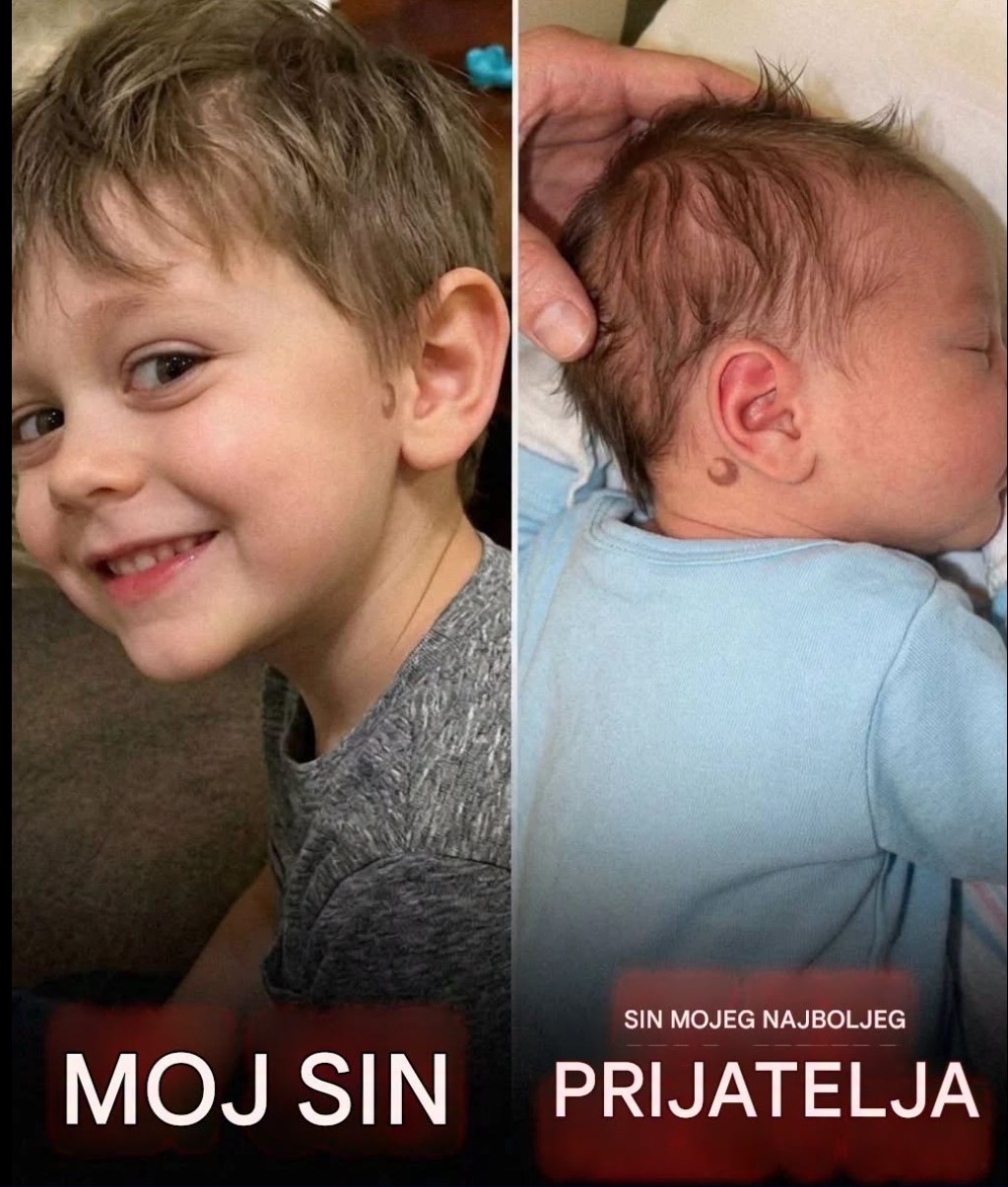 Mislila Sam Da Me Muž Vara Sa Najboljom Prijateljicom Zbog Istog Retkog Belega Na Bebama: Istina Iz Klinike Za Plodnost Bila Je Mnogo Gora