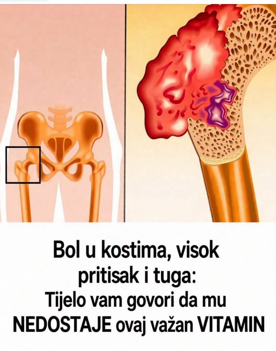 Skriveni Uzrok Hroničnog Umora i Bolova: Simptomi Koji Ukazuju na Manjak “Sunčevog Vitamina”