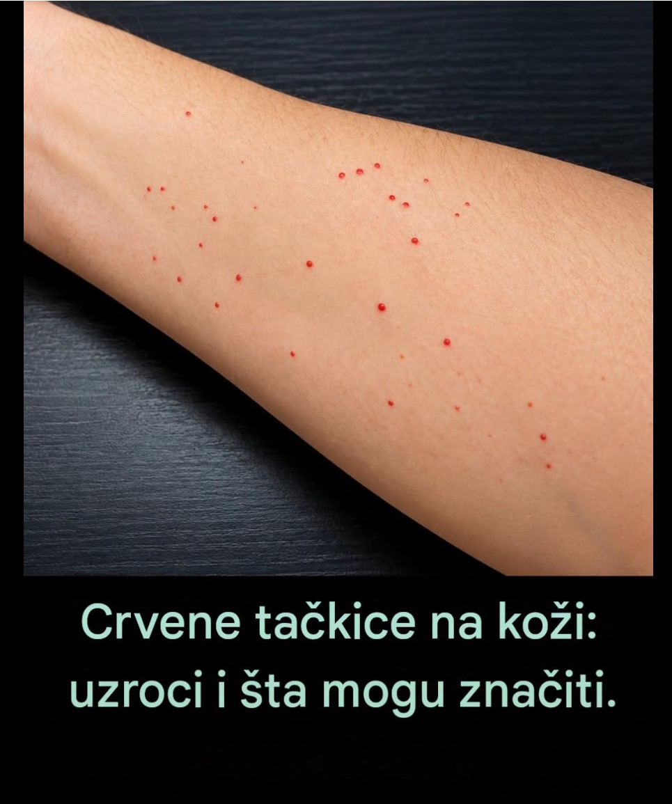 Crvene tačkice na koži: Šta mogu značiti i koji su najčešći uzroci