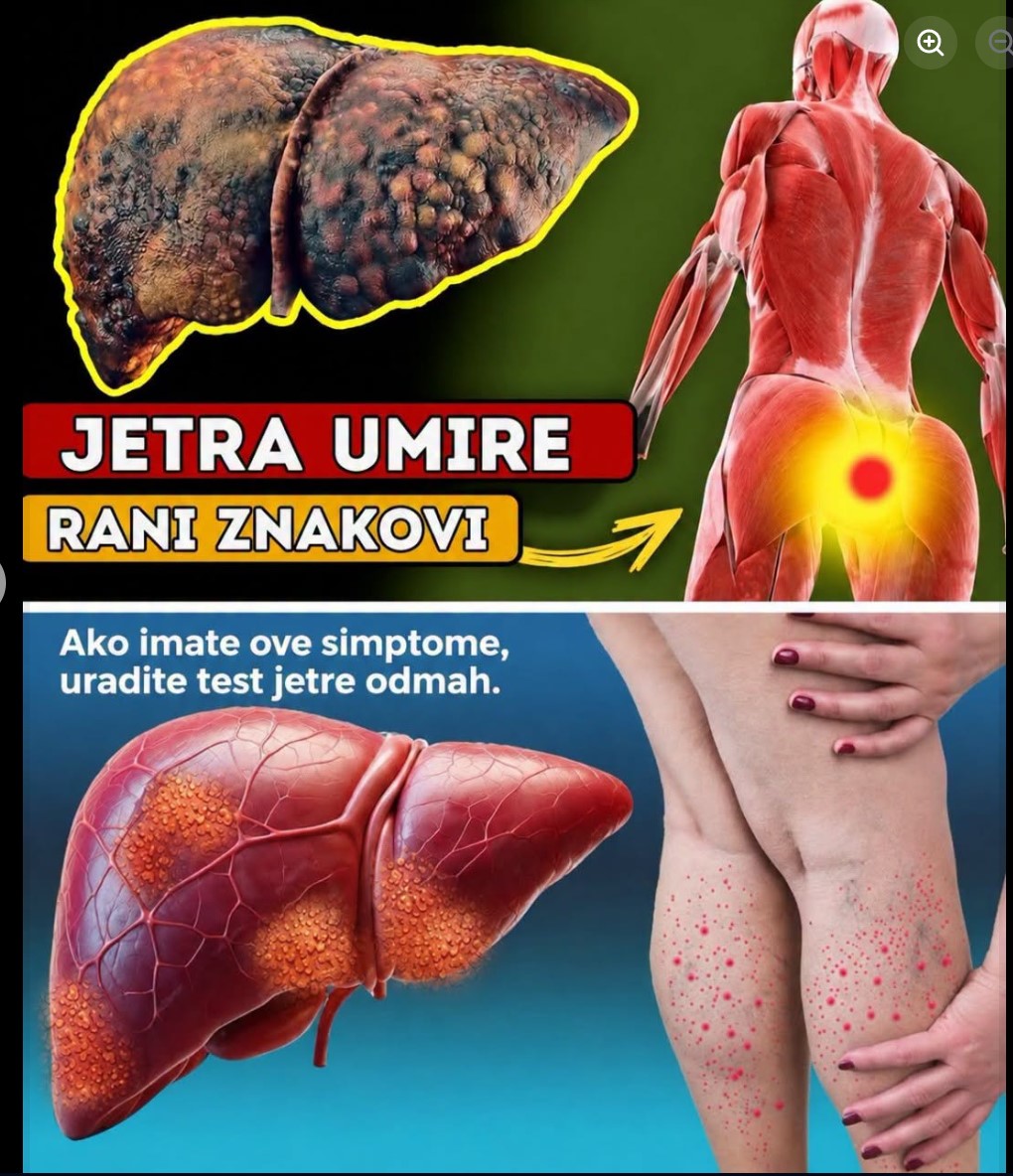 Skriveni signali tijela: Kako prepoznati da jetra ne radi kako treba
