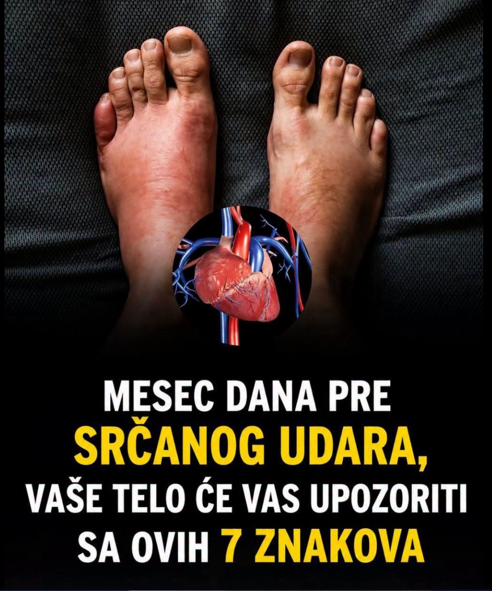7 ranih znakova koje tijelo može pokazivati nekoliko nedjelja prije srčanog udara