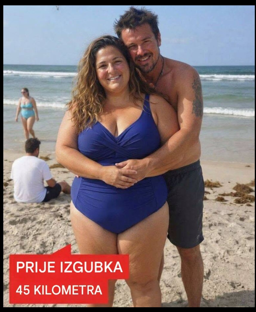 Imala sam liposukciju nakon što sam smršala 45 kilograma – Moj muž je postavio jedan zahtev onog trenutka kada sam stigla kući
