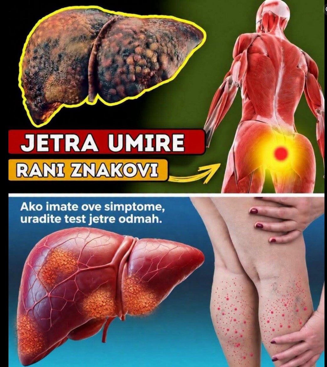 Tih Upozorenja Organa Koja Često Zanemarujemo: Kako Tijelo Signalizira Poremećaj Rada Jetre
