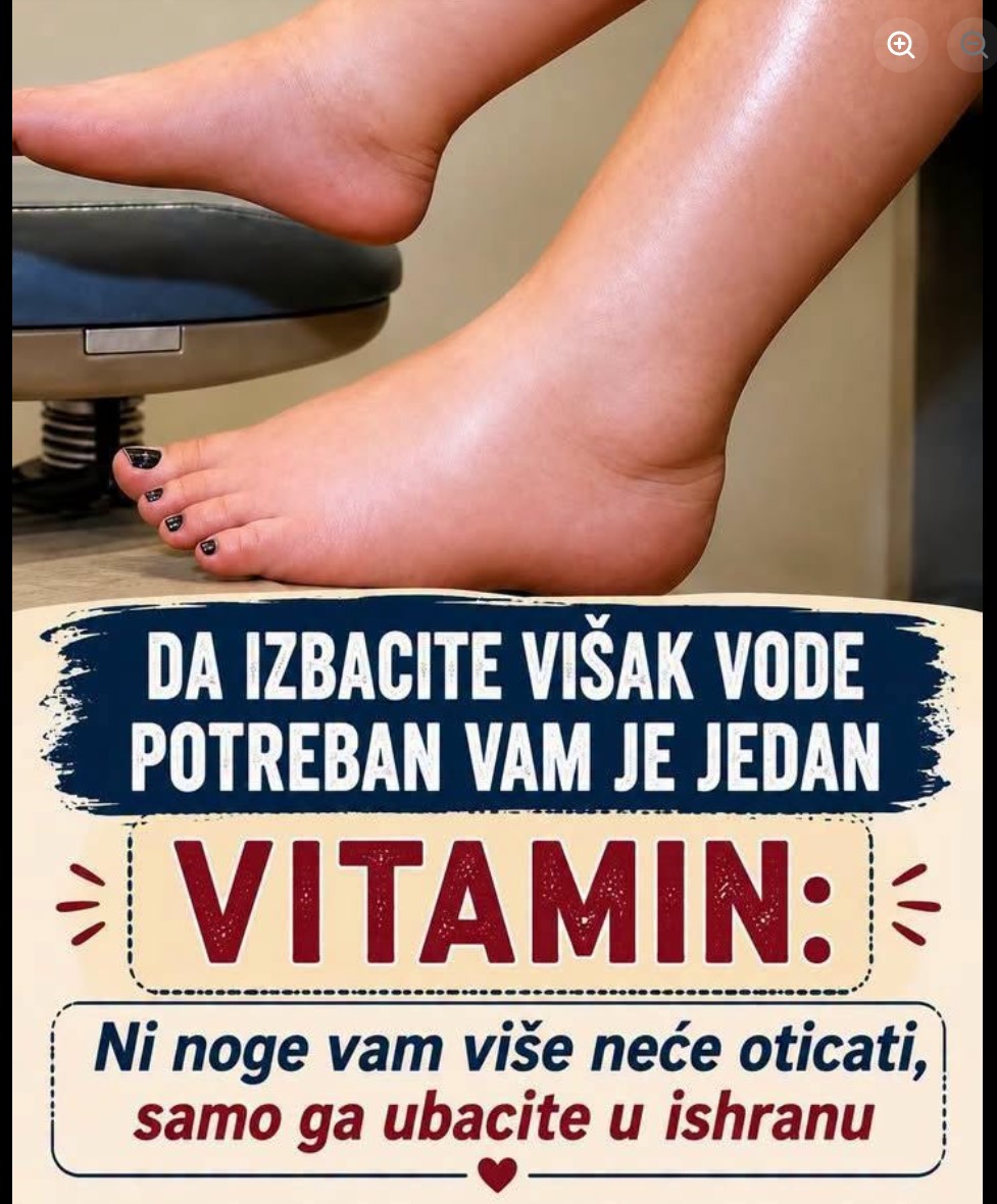 Oticanje nogu i zadržavanje tečnosti: da li magnezijum zaista može da pomogne?