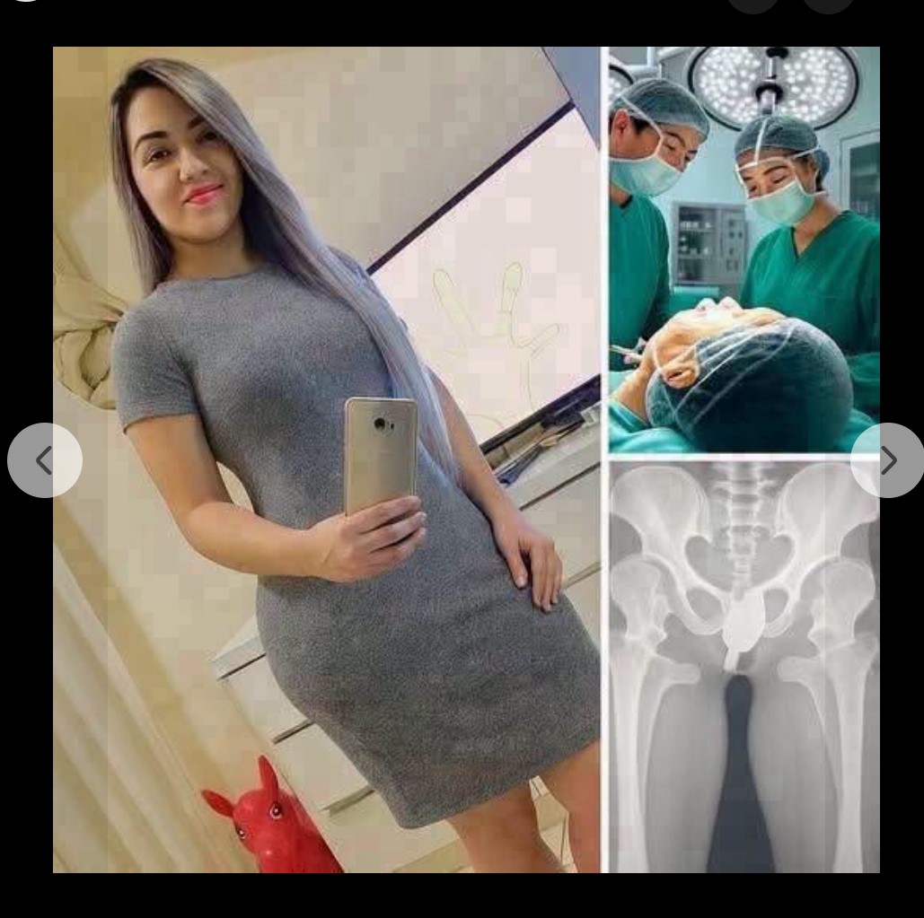 Lekari upozoravaju nakon ozbiljnog incidenta: Nepravilna upotreba predmeta može izazvati teške zdravstvene posledice