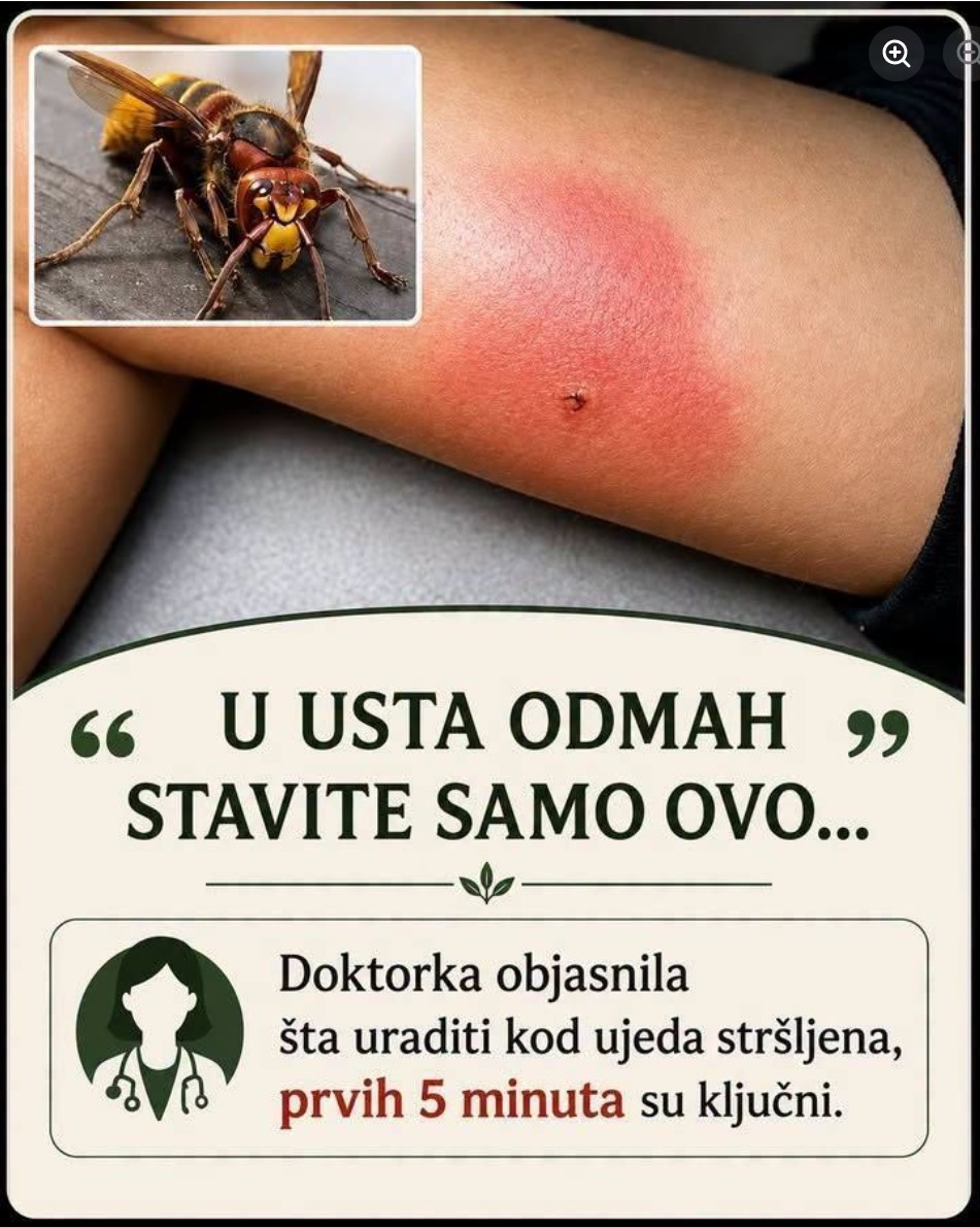 Ujed stršljena: šta uraditi odmah i kada pozvati hitnu pomoć