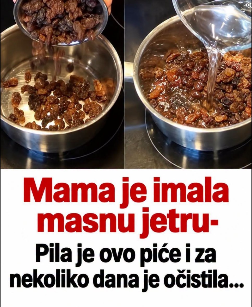 Voda sa suvim grožđem: Da li ovaj napitak zaista može da „očisti“ masnu jetru?