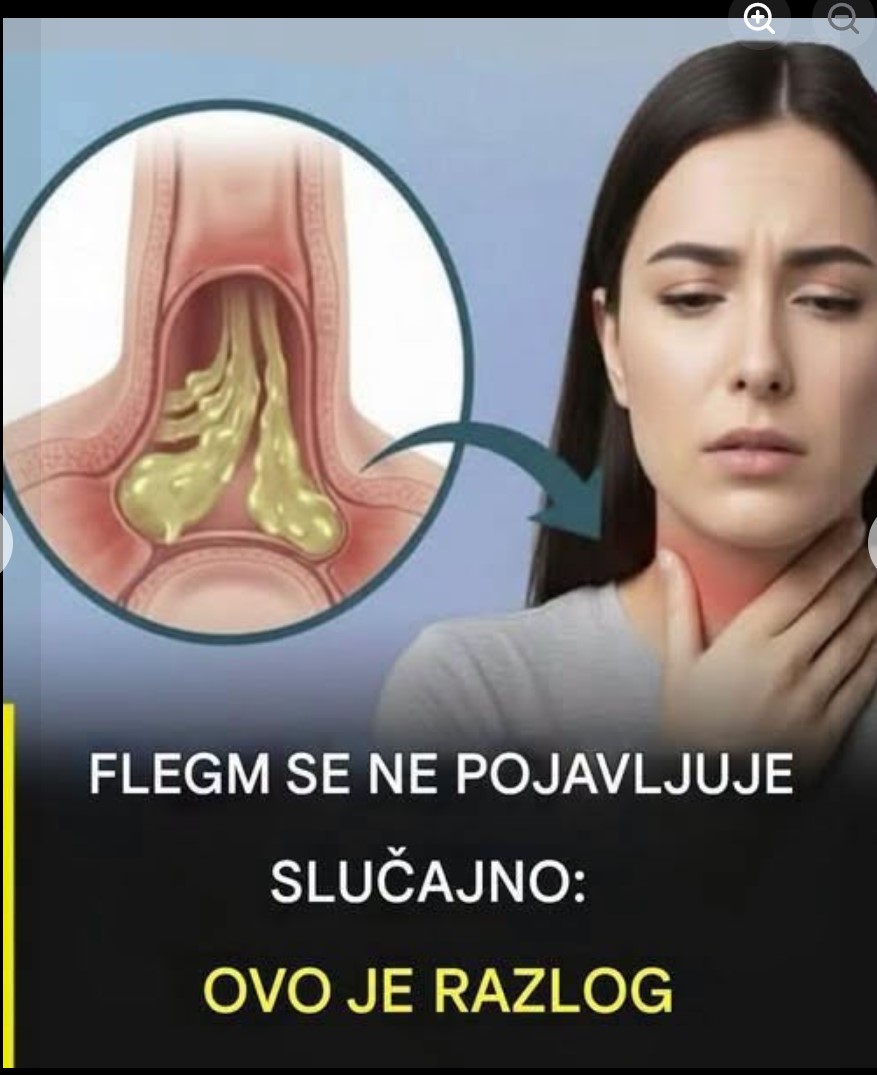 Muči vas gust sekret u grlu i disajnim putevima? Ove navike mogu olakšati njegovo izbacivanje