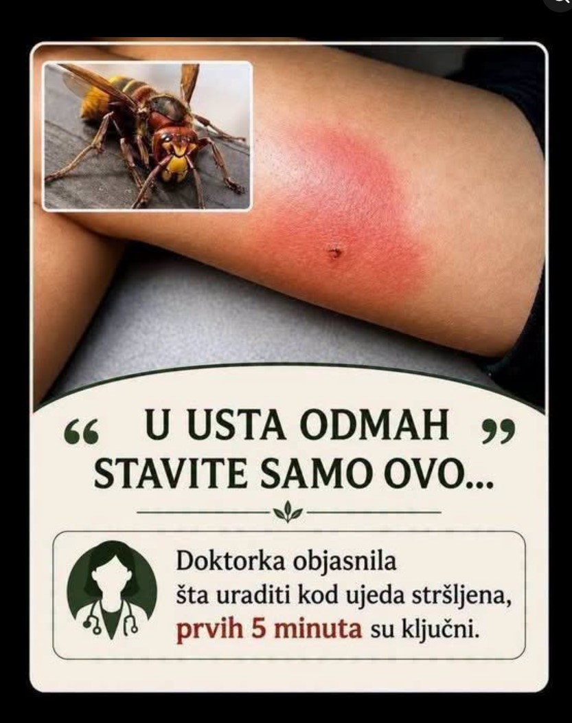 Ubod stršljena: Prepoznajte opasne simptome i reagujte na vrijeme