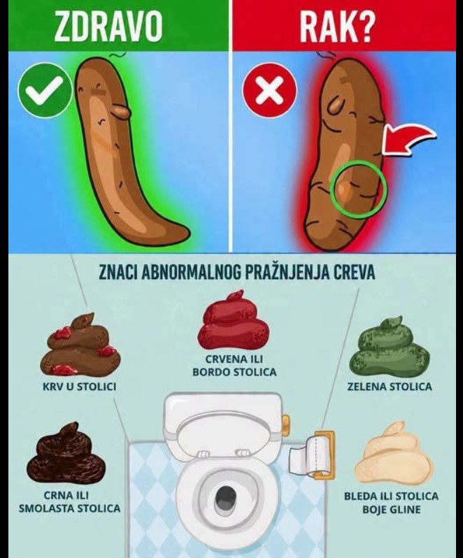 Šta boja stolice može da otkrije o vašem zdravlju? Vodič za razumijevanje promjena