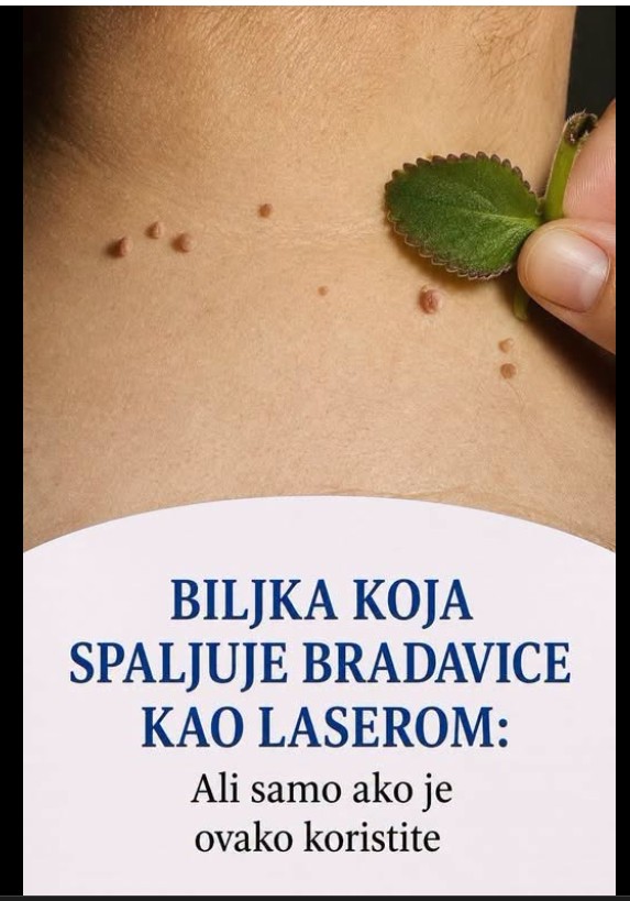 Rusa (Chelidonium majus): tradicionalna biljka za bradavice i podršku jetri i disajnim putevima – kako se koristi i šta je važno znati